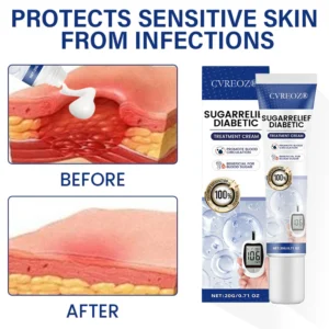 Cvreoz® SugarRelief Diabetic Treatment Cream