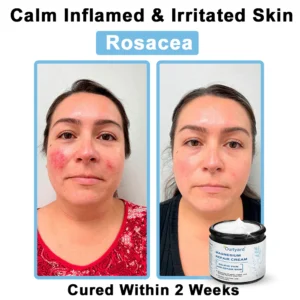 Ourlyard® Magnesium skin repair cream