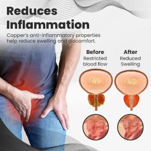 Histone™ Copper Mag Prostate Therapy Ring image Histone™ Copper Mag Prostate Therapy Ring