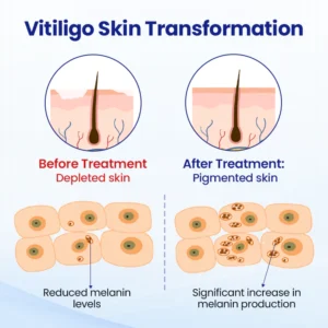 Timilk® VitiClear Herbal Spray