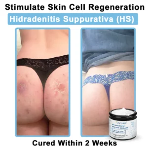 Ourlyard® Magnesium skin repair cream