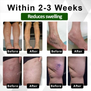 ATTDX ClearCirculate Soursop Edema Detox Drops11