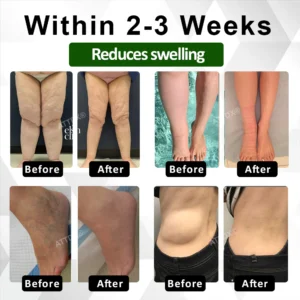 ATTDX ClearCirculate Soursop Edema Detox Drops12