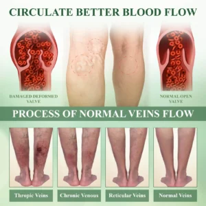 DetoxFlow SwellRelief Lymphatic Foot Pads 05