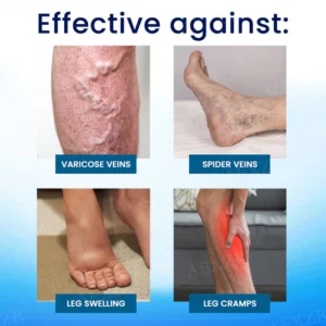 Cvreoz® Herbal Varicose Veins Treatment Spray - ✅ Clinically proven to eliminate varicose veins in just 7 days!