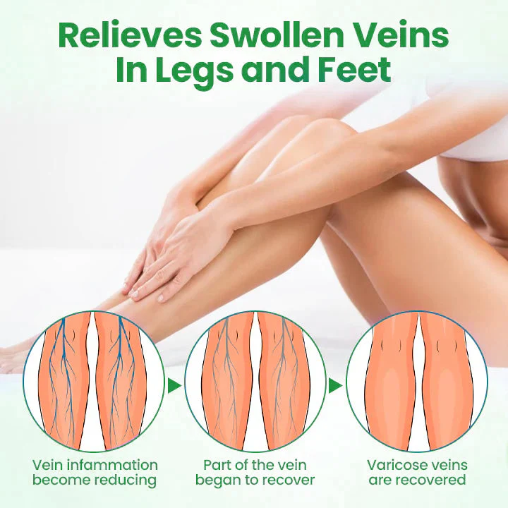 ADFIRE® VeinGuard Herbal Spray image ADFIRE® VeinGuard Herbal Spray