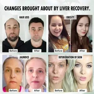 LiverPlus® FGF21 Liver Support Weight Loss Oral Solution image LiverPlus® FGF21 Liver Support Weight Loss Oral Solution