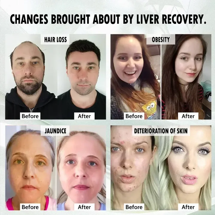 LiverPlus® FGF21 Liver Support Weight Loss Oral Solution image LiverPlus® FGF21 Liver Support Weight Loss Oral Solution - Image 4