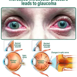 NESLEMY™ Nano Vision Repair Eye Serum