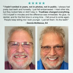 Bikenda®, Advanced Customised Dentures Set