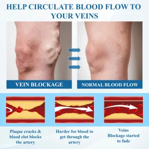 ATTDX® VeinFocus Microneedle Leg Patch