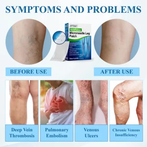ATTDX® VeinFocus Microneedle Leg Patch