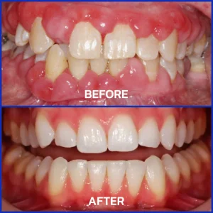 Dobshow® Bee Venom Dental Microgranules