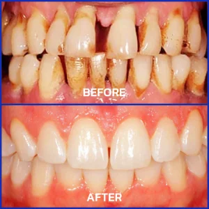Dobshow® Bee Venom Dental Microgranules