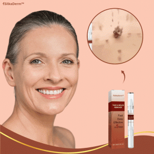 DermaLift™ Pen | Removes warts and age spots