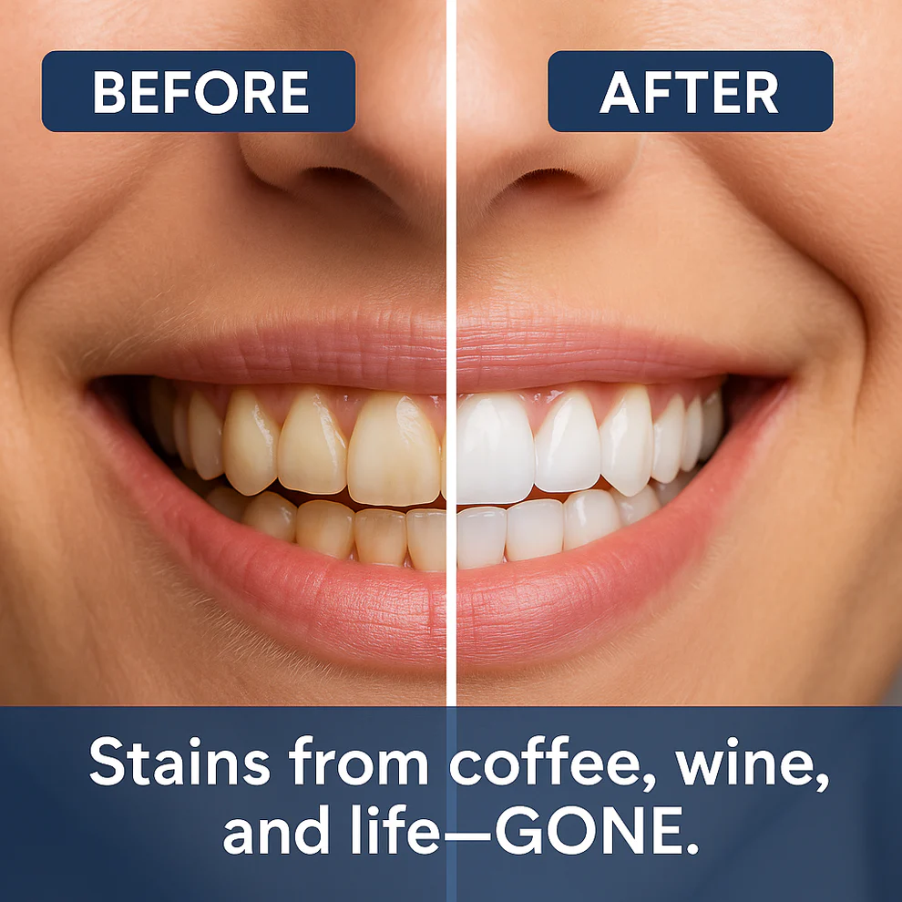 Newyuo® Nicotinamide Toothpaste image Newyuo® Nicotinamide Toothpaste