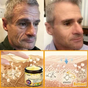 Laozik™ Skin Restoration Cream image Laozik™ Skin Restoration Cream