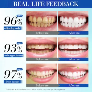 Alisanda Hydroxyapatite Toothpaste 7.5% for Enamel Repair & Teeth Whitening Refreshing Flavor Fluorid image Alisanda Hydroxyapatite Toothpaste 7.5% for Enamel Repair & Teeth Whitening Refreshing Flavor Fluorid