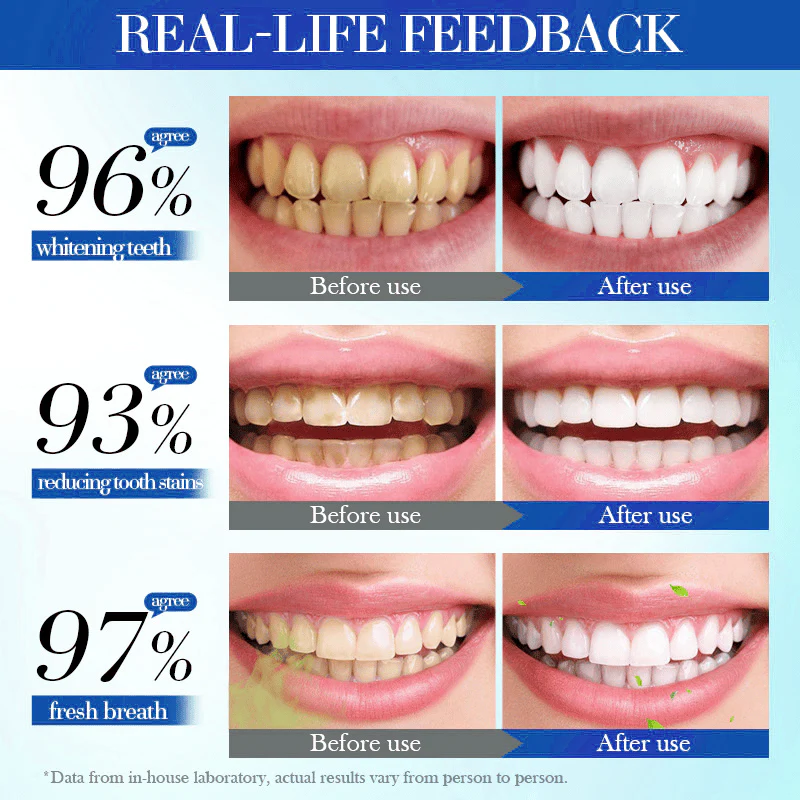 Alisanda Hydroxyapatite Toothpaste 7.5% for Enamel Repair & Teeth Whitening Refreshing Flavor Fluorid image Alisanda Hydroxyapatite Toothpaste 7.5% for Enamel Repair & Teeth Whitening Refreshing Flavor Fluorid