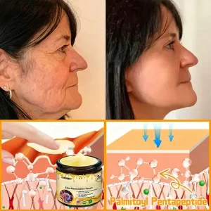 Laozik™ Skin Restoration Cream image Laozik™ Skin Restoration Cream