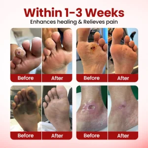 Yagoo® VitaGluco Diabetic Care Cream image Yagoo® VitaGluco Diabetic Care Cream