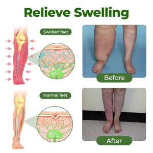 BBOJI® Professional Leg Circulation Cream image BBOJI® Professional Leg Circulation Cream