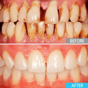 Lyyeto® Focussmile bee venom treatment powder for oral use image Lyyeto® Focussmile bee venom treatment powder for oral use