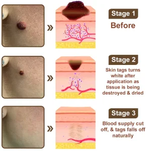 LOVILDS® Black Rice Skin Repair Essence Cream image LOVILDS® Black Rice Skin Repair Essence Cream