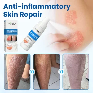 Timilk® Magnesium Herbal Treatment Spray image Timilk® Magnesium Herbal Treatment Spray