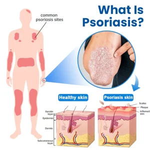 Timilk® Magnesium Herbal Treatment Spray image Timilk® Magnesium Herbal Treatment Spray