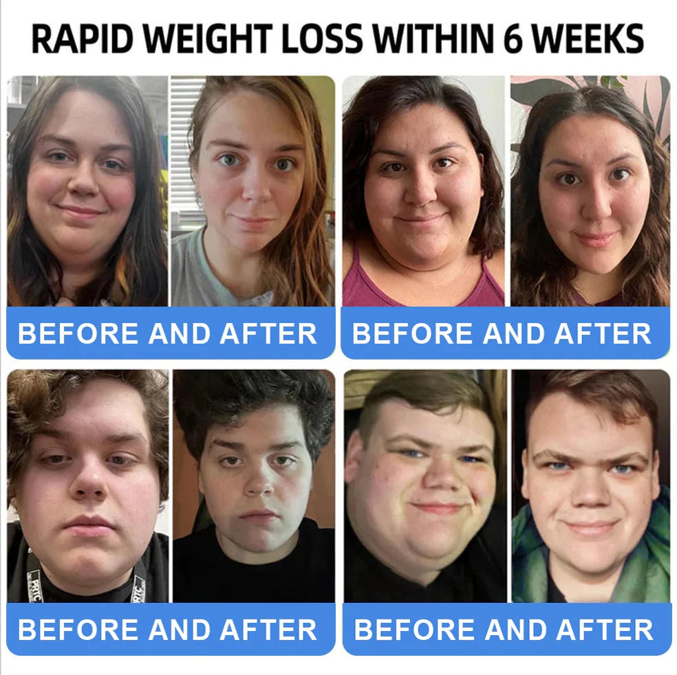 Thonesr® GLP-1 Pro+ Six in One Health Solution Oral Liquid image Thonesr® GLP-1 Pro+ Six in One Health Solution Oral Liquid