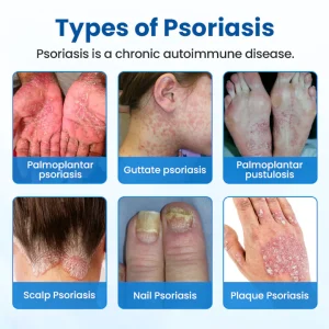 Timilk® Magnesium Herbal Treatment Spray image Timilk® Magnesium Herbal Treatment Spray