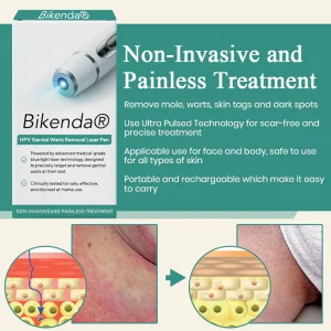 Bikenda® HPV Genital Warts Removal Laser Pen image Bikenda® HPV Genital Warts Removal Laser Pen