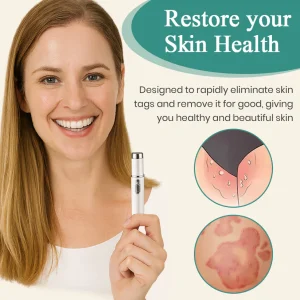 Bikenda® HPV Genital Warts Removal Laser Pen image Bikenda® HPV Genital Warts Removal Laser Pen