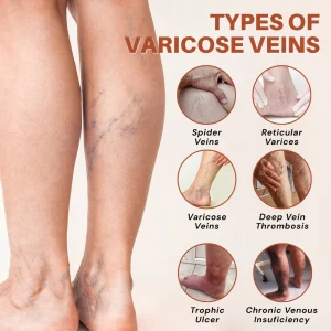 ATTDX® VeinTarget Nanotech Microneedle Patch image ATTDX® VeinTarget Nanotech Microneedle Patch