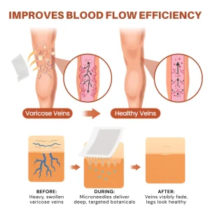 ATTDX® VeinTarget Nanotech Microneedle Patch image ATTDX® VeinTarget Nanotech Microneedle Patch