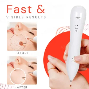 Bikenda® Portable Skin Care Laser Pen image Bikenda® Portable Skin Care Laser Pen