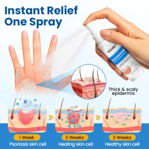 Timilk® Magnesium Herbal Treatment Spray image Timilk® Magnesium Herbal Treatment Spray