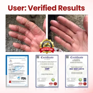 Timilk® VitaGluco Diabetic Care Cream image Timilk® VitaGluco Diabetic Care Cream