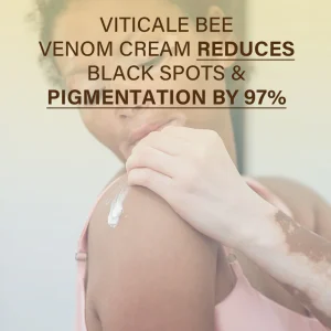 Oveallgo® VitiClear Bee Venom Cream Ultra image Oveallgo® VitiClear Bee Venom Cream Ultra
