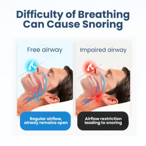 Lyyeto® Snoreless Nasal Breather image Lyyeto® Snoreless Nasal Breather