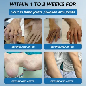 flysmus® BPC-157 Joint Healing Cream