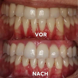 Seurico™ Gum Repair & Oral Health Powder image Seurico™ Gum Repair & Oral Health Powder