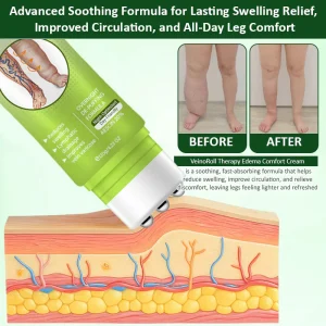 Oveallgo® VeinoRoll Therapy Edema Comfort Cream image Oveallgo® VeinoRoll Therapy Edema Comfort Cream