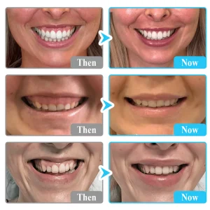 Lyyeto® Focussmile bee venom treatment powder for oral use image Lyyeto® Focussmile bee venom treatment powder for oral use