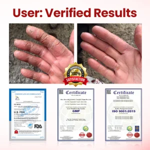 Yagoo® VitaGluco Diabetic Care Cream image Yagoo® VitaGluco Diabetic Care Cream