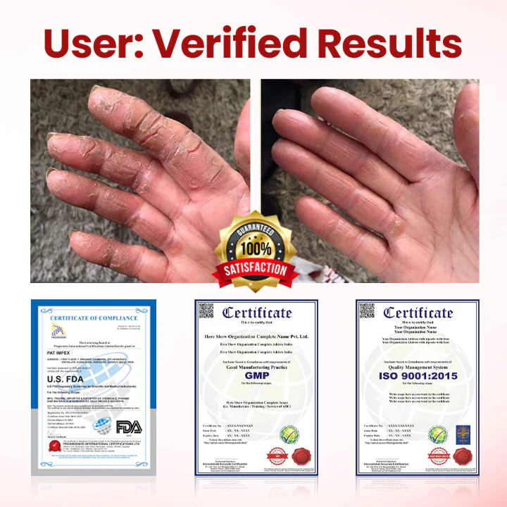 Yagoo® VitaGluco Diabetic Care Cream image Yagoo® VitaGluco Diabetic Care Cream