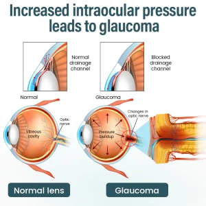 Piguiay® OptiFusion Nano Eye Drops Serum image Piguiay® OptiFusion Nano Eye Drops Serum