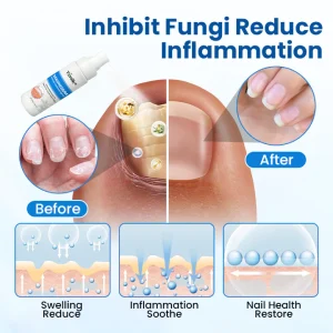 Timilk® Magnesium Herbal Treatment Spray image Timilk® Magnesium Herbal Treatment Spray