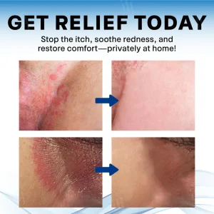 Fivfivgo® Scrotum Itchy Treatment Cream image Fivfivgo® Scrotum Itchy Treatment Cream